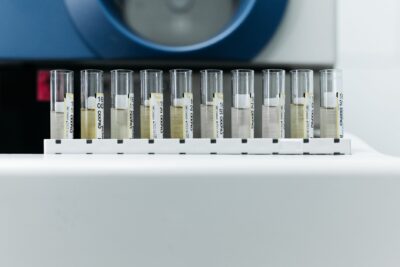 ¿Funcionan realmente las pruebas de plomo en el hogar?